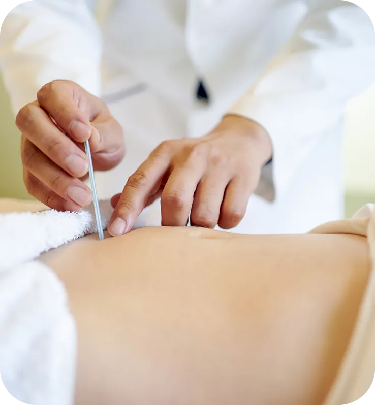 訪問はり灸（鍼灸）で期待される効果